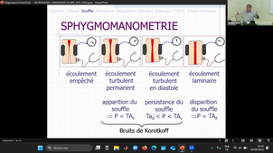 DFGSM3 : UE Appareil Cardiovasculaire - CM10 et CM11 - D. Mariano-Goulart - 23/09/2025