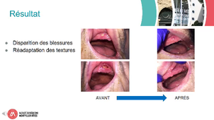 CM2529_HACQUARD MA_Cas clinique la blessure buccale.mp4