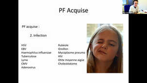 DU de chirurgie plastique pédiatrique Pr Pierre Guerreschi, Paralysie faciale congénital 05/02/2021