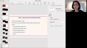 Evaluation Echographie des cardiomyopathies hypertrophiques - suite - Dr SOULLIER