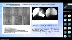 DU Douleur - 21 janvier 2026 (3).mp4