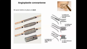 HLBI404_physio cardiovasculaire_CM2_diapo 42 à 87