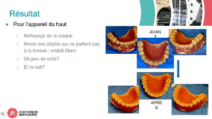 CM2520_MA HACQUARD_Cas clinique hygiene orale.mp4