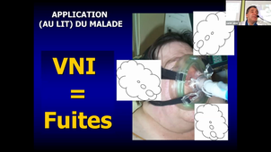 DU Approche des techniques de soins en réanimation - 27 01 2021 - Matin - partie 4