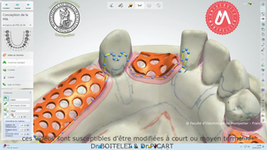 2025_MAND_K32_étape3_armature.mp4