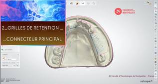 3SHAPE2025_PPAM MD 02 rétention & connecteur principal.mp4