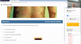 DFASM1 MIB (03/11/2020) O. DEREURE / Lymphomes malins - Tumeurs cutanées, épithéliales et mélaniques ET 