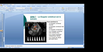 DFASM2 MIE 05/01/2021	11:00	12:00	Prise en charge d'une patiente atteinte de pré-eclampsie	BEGUE Laetitia	TD308	MIE