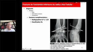Best Of MIC - Orthopédie des membres supérieurs - Pr CHAMMAS
