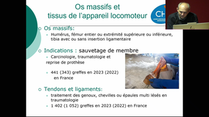 MAM2BTMR_M2S1_Pr.Couderc_La_thérapie_tissulaire_et_la_banque_de_tissu_19/11/2024