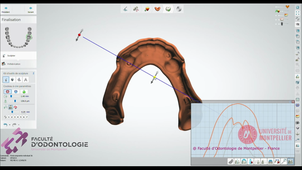 2025_3SHAPE2025_PEI_02_accessoires & finalisation.mp4