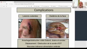 DU Approche des techniques de soins en réanimation - 27 01 2021 - Matin - partie 2
