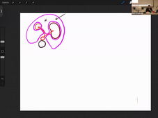 13-02-26-DFGSM2-Appareil digestif-M Bertrand-CM6.mp4