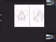 10-02-23-DFGSM2-CM1-appareil rénal-M Bertrand.mp4