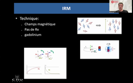 Principes thérapeutiques de la radiologie interventionnelle - Pr J. Frandon