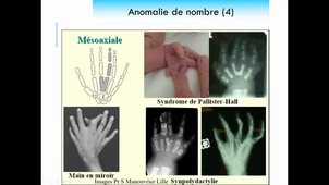 DIU médecine foetale 14/04/2021
