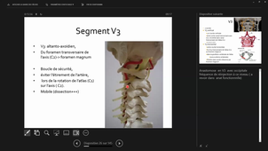 05-10-23-DFGSM2-CM7-Appareil neuro-S Coudray.mp4