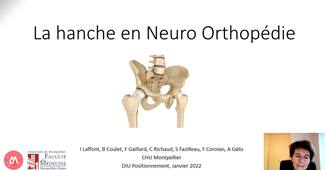 La hanche en neuro-orthopédie. Pr Laffont