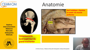 EPI Muscle Piriformis