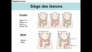 DFASM1 MIB 05/03/2021	16:00	18:00	Maladie de Crohn et rectocolite hémorragique, Vomissement de l'adulte	P. BLANC	salle 301	4010930964	MIB