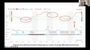 DIU GIA - Enregistrements n°2 - Mercredi 19 novembre 2025.mp4