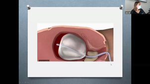 23/03/2021	16:00	18:00	Suites de couches normales et pathologiques. Allaitement maternel. Promotion, initiation, complications	RAYSSIGUIER Romy	308		MIE