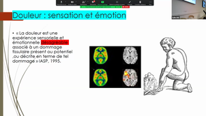 Neurophysiologie des douleurs périnéales et comment les traiter - Dr BREDEAU