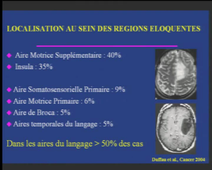 Session 1 : Approches Innovantes Perspectives apportées par l'Oncologie Moléculaire dans la prise en charge des GLIOMES