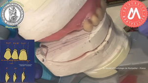 2023VB_montage MAX_dents antérieures.mp4