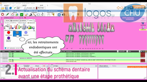 Utilisation de LOGOSw en Odontologie Prothétique