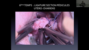 CM DU MERC 13 MARS APRES MIDI.mp4