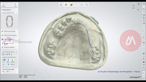 2026_3ShapeDM2025_commande et accentuation des limites maxillaires.mp4
