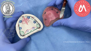 2023VB_PEI MAX confection des bourrelets de préhension.mp4