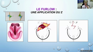 DU CPP - Pr. Duquennot - Plasties et lambaux chez l'enfant