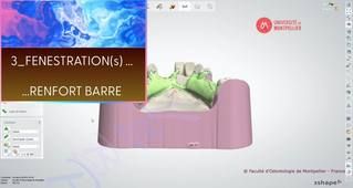 3SHAPE2025_PPAM MD 03 fenestration & renfort barre.mp4