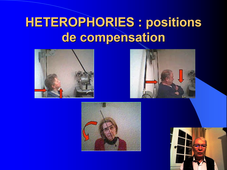 Generalite_Theorie_Vision tests de convergence