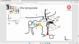 AMPHITHEATRE UPM - DFGSM2 UE TÊTE ET COU - CM3 MUSCLES ET FASCIA DE LA TÊTE ET DU COU - G. CAPTIER - 10/02/26