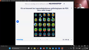 DFGSM2 - Module appareil neurosensoriel - 21/04/2026