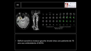DFASM3 ATELIER 10/03/2021	16h30	18h00	Ateliers d'imagerie - imagerie neuro-ORL-OPH	MENJOT DE CHAMPFLEUR Nicolas	Amphi UPM		DFASM3