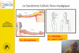 Examen  du Rachis SD CTM CERV