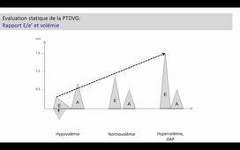PR MULLER SYNTHESE HEMODYNAMIQUE.mp4