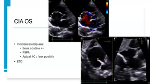 Communications inter atriales_Dr FEMENIA.mp4