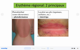 15/02/2021	16:00	17:00	Sémio 2 : Signes fonctionnels et examen physique DERMATOLOGIE (CM8)	Aurélie DU THANH	Amphi Rabelais	DFGSM3