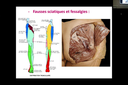 Pr MICHEL - Trim.mp4