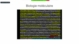 DFASM1 MIB (20/10/2020) L. GABELLIER Introduction à l'hématologie maligne (CM) + Pathologie de la lignée leucocytaire maligne (ED-1)