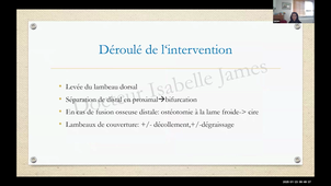 DU CPP - Pr. James - La syndactylie embryonnaire.mp4