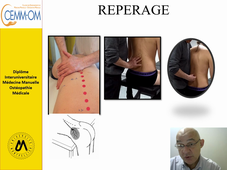 Manipulation vertebrale- Jonction thoraco- lombaire Assise en Rotation