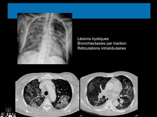 Patients particuliers savoir y penser