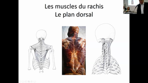 Anatomie du rachis cervical dissection Dr Dominique BONNEAU.mp4