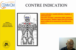 RACHIS DECORDAGE AXIAL INTER EPINEUX